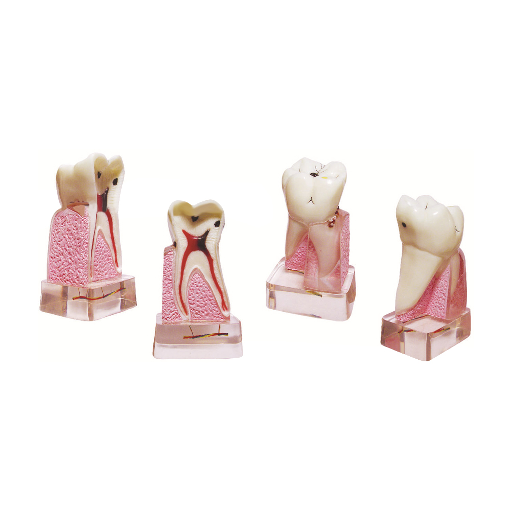 Dental Pathological Model, 4x  - Medical Lab Supplies ulasan dan harga