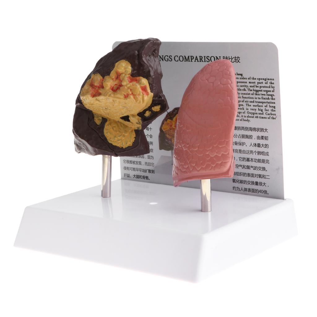 Human Lung Normal Comparison M - Medical Lab Supplies ulasan dan harga