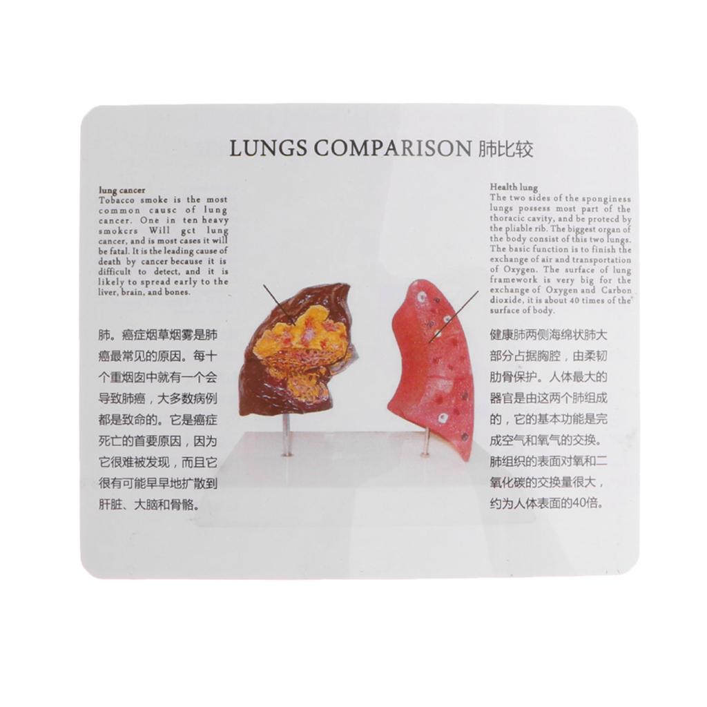 Human Lung Normal Comparison M - Medical Lab Supplies ulasan dan harga