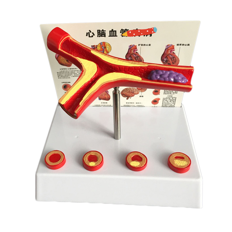50 Times Enlarged Human Vessel - Medical Lab Supplies ulasan dan harga