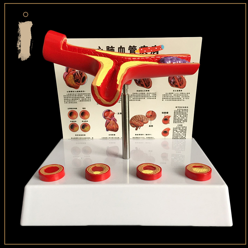 50 Times Enlarged Human Vessel - Medical Lab Supplies ulasan dan harga