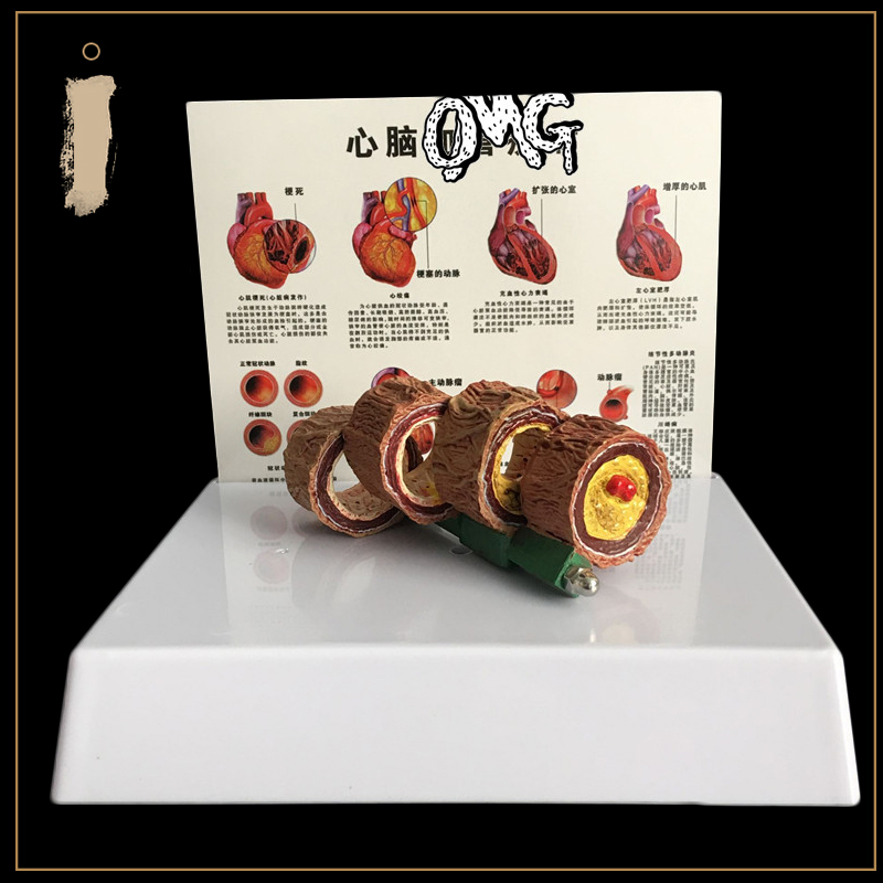 50 Times Enlarged Human Vessel - Medical Lab Supplies ulasan dan harga